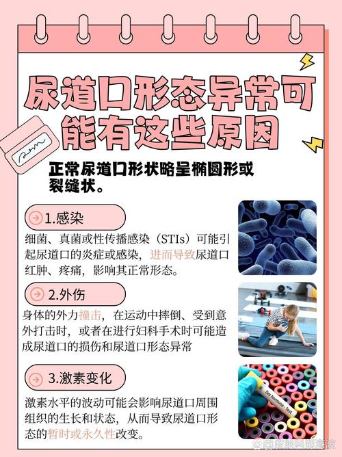 米奇7777狠狠狠狠视频影院的相关介绍